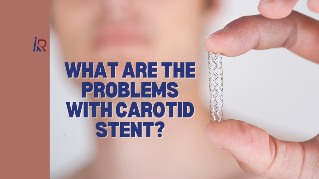 Varicose Vein Doctor in Indore