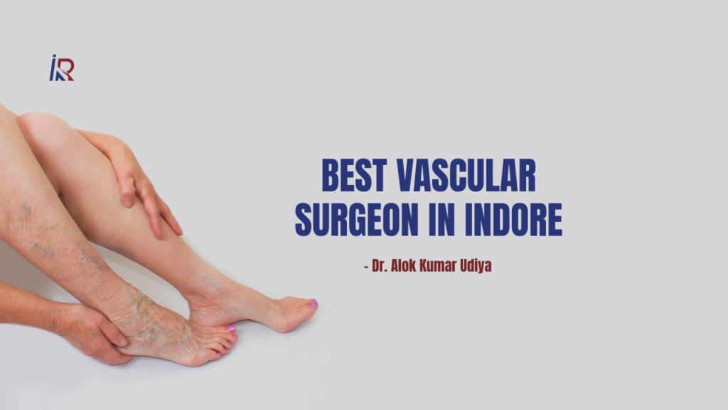 Best Vascular Surgeon in Indore