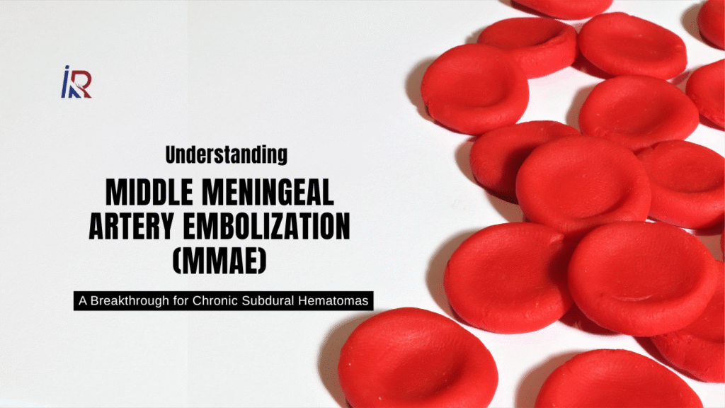 Middle Meningeal Artery Embolization
