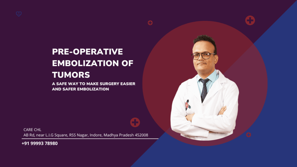 Pre-Operative Embolization of Tumors