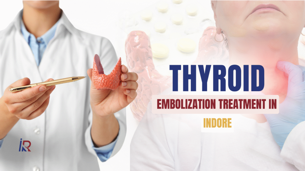 Thyroid Embolization Treatment