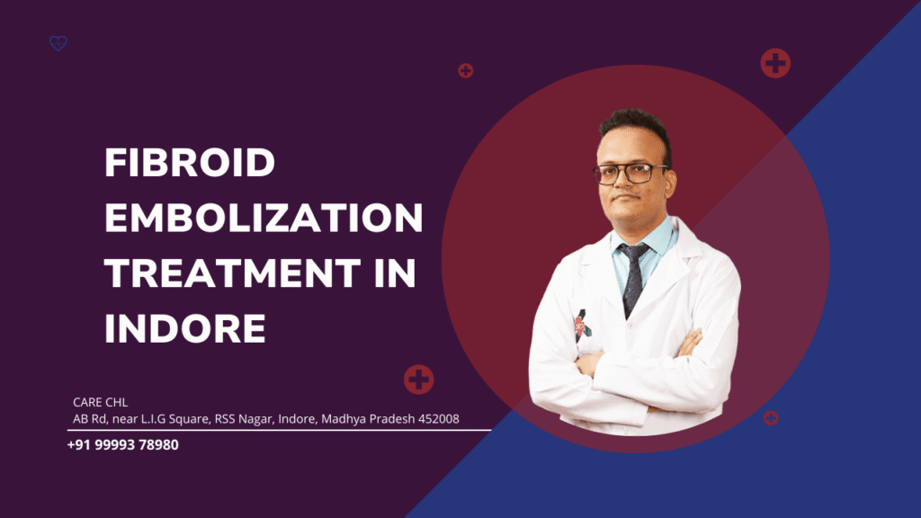 Fibroid Embolization Treatment in Indore