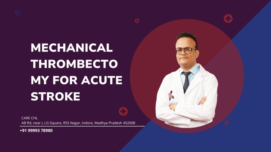 Mechanical Thrombectomy for Acute Stroke