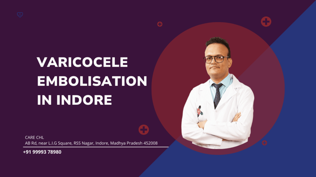 Varicocele Embolisation in Indore