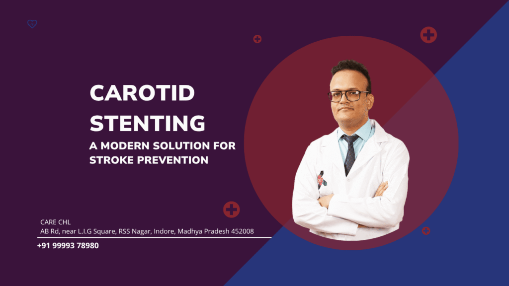 Carotid Stenting: A Modern Solution for Stroke Prevention