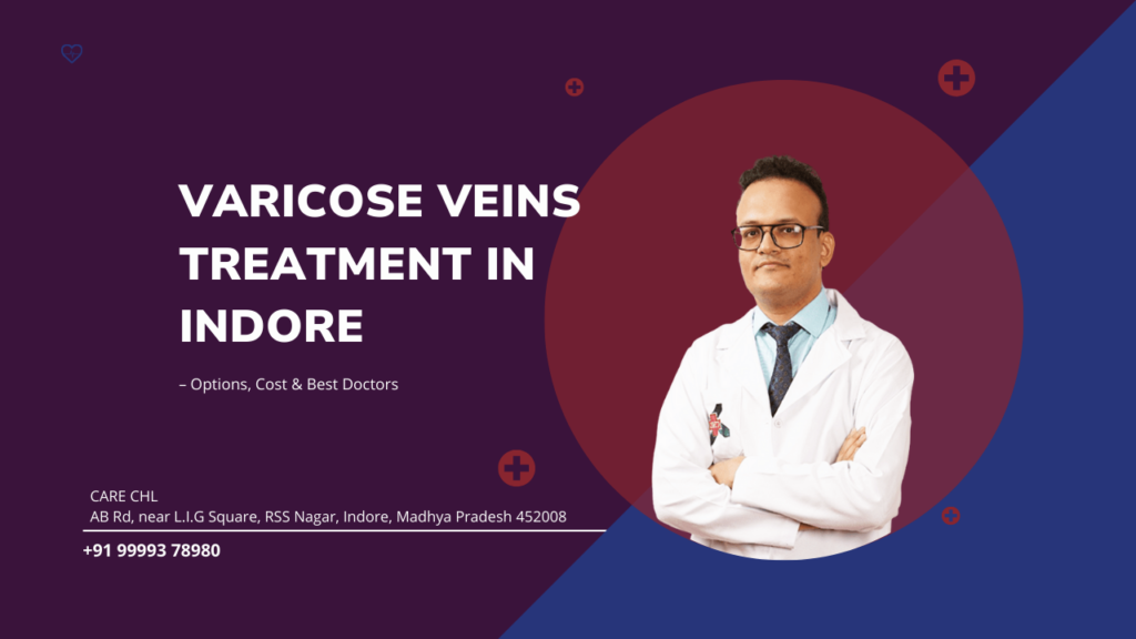 Varicose Veins Treatment in Indore