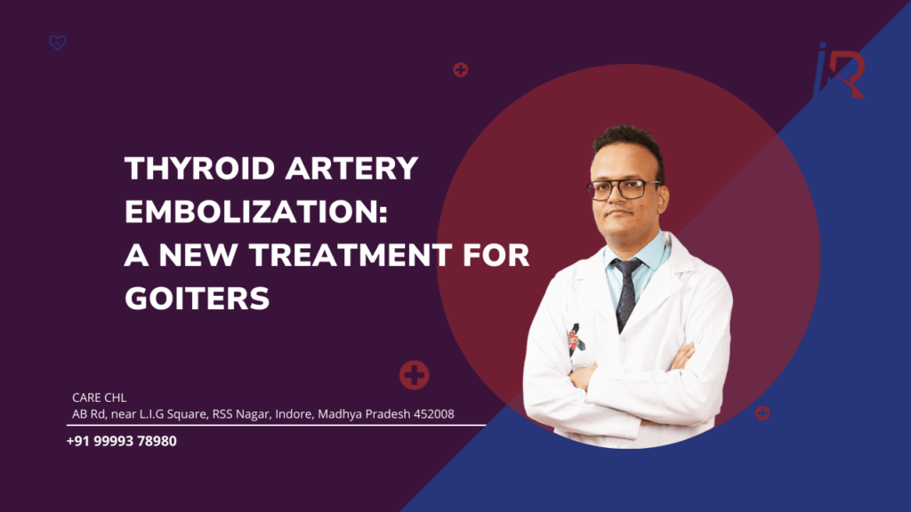 Treatment for Goiters