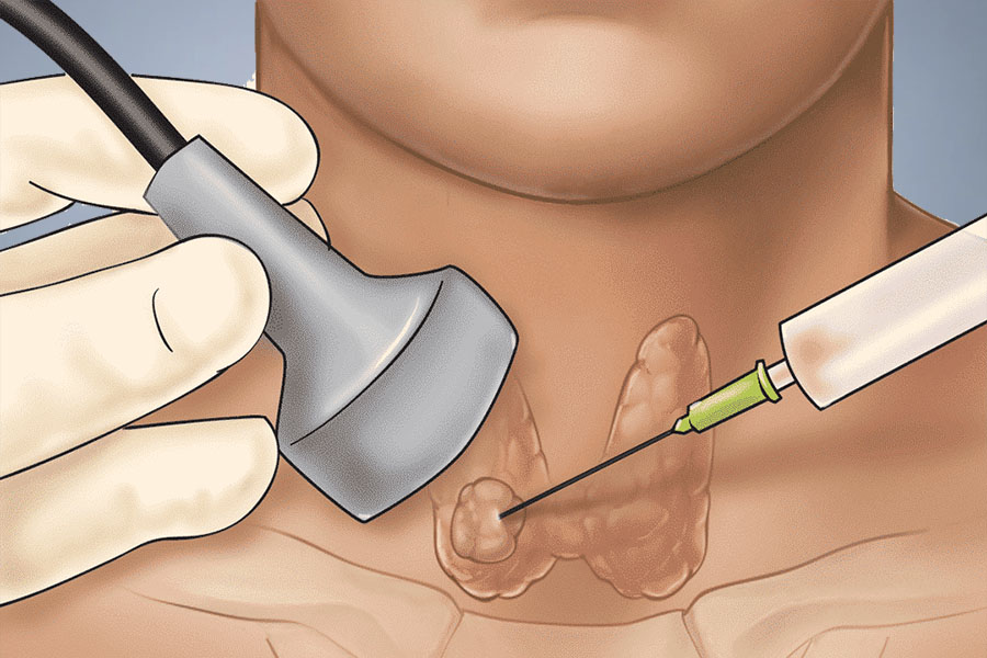 Image-guided Biopsy