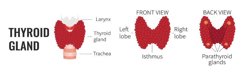 Is Thyroid Embolization Painful? 3 Thyroid Embolization