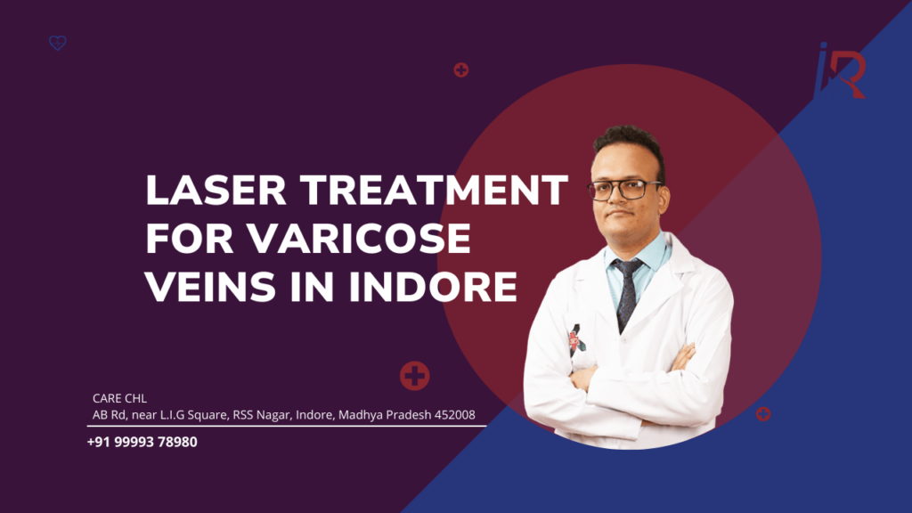 Laser Treatment for Varicose Veins in Indore