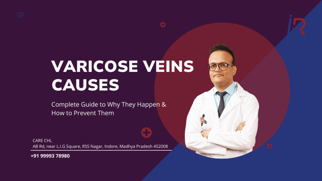 Varicose Veins Causes