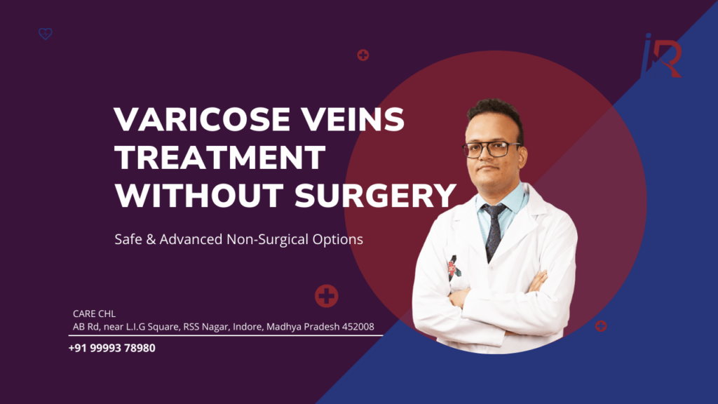 Varicose Veins Treatment Without Surgery