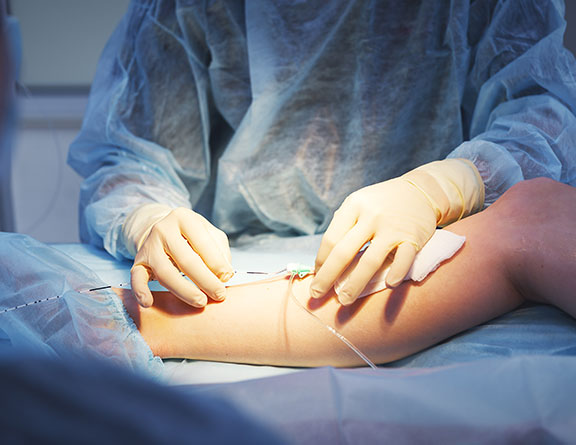 Laser Treatment for Varicose Veins in Indore 1 Laser Treatment for Varicose Veins in Indore