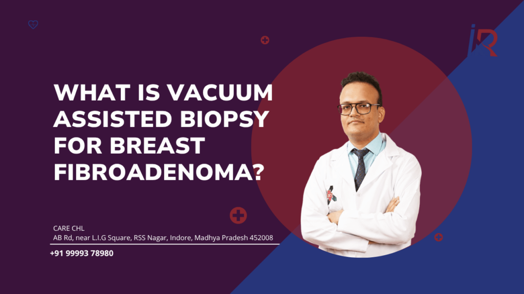 What is Vacuum Assisted Biopsy for Breast Fibroadenoma? | Intervention Radiology Indore