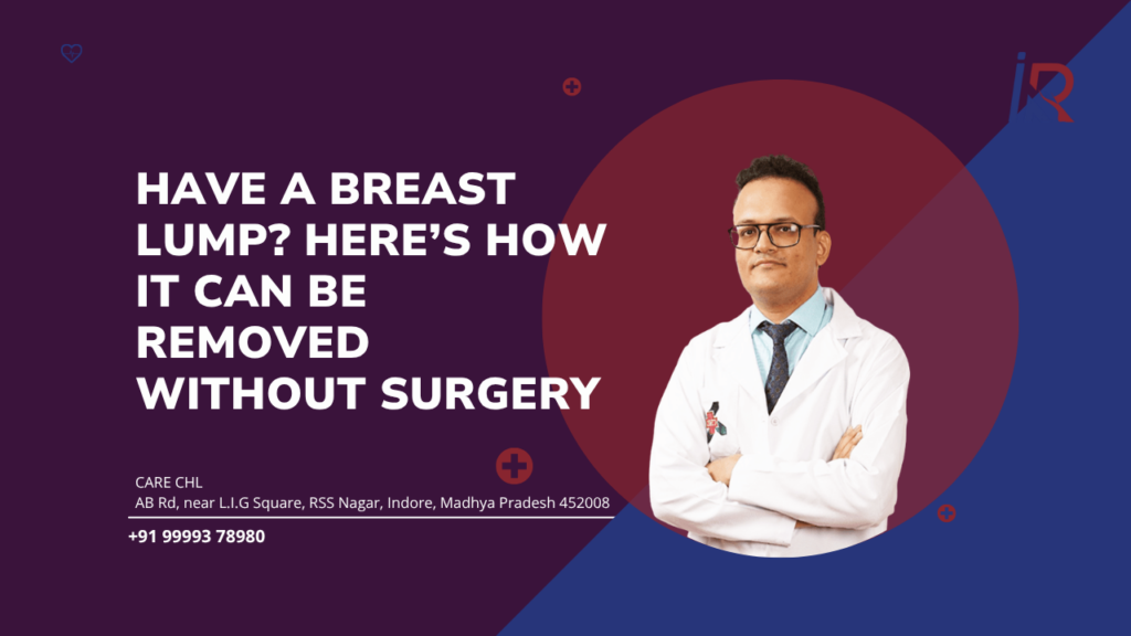 Have a Breast Lump? Here’s How It Can Be Removed Without Surgery