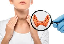 Thyroid Cyst Treatment Without Surgery: Safe & Effective Options 2 Thyroid Cyst Treatment Without Surgery