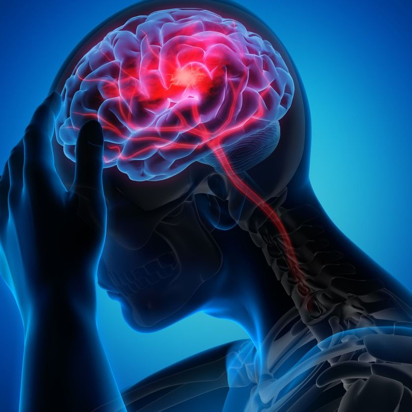 Best Neuro Doctor in Indore for Stroke Treatment: Expert Care You Can Trust 2 Best Neuro Doctor in Indore