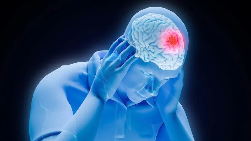 Top Stroke Treatment Specialist Near Me for Fast Recovery Care 1 Top Stroke Treatment Specialist Near Me