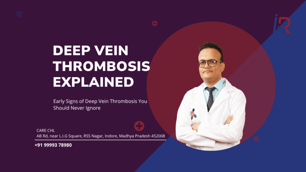 DVT Explained: Early Signs of Deep Vein Thrombosis You Should Never Ignore
