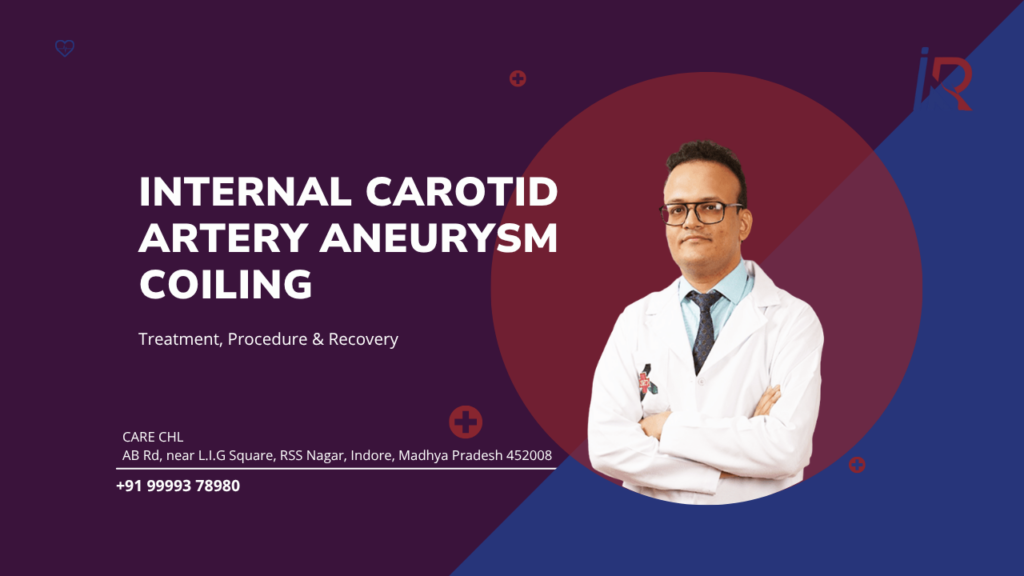 Internal Carotid Artery Aneurysm Coiling: Treatment, Procedure & Recovery