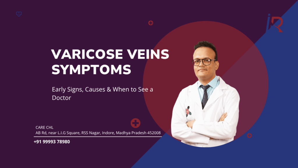 Varicose Veins Symptoms: Early Signs, Causes & When to See a Doctor
