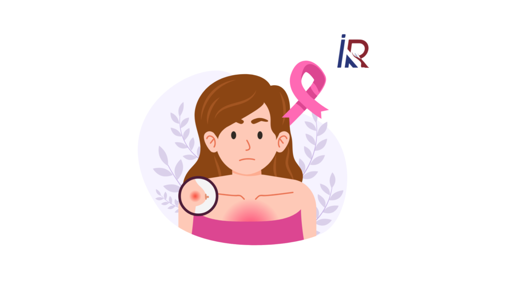 Say Goodbye to Breast Lumps