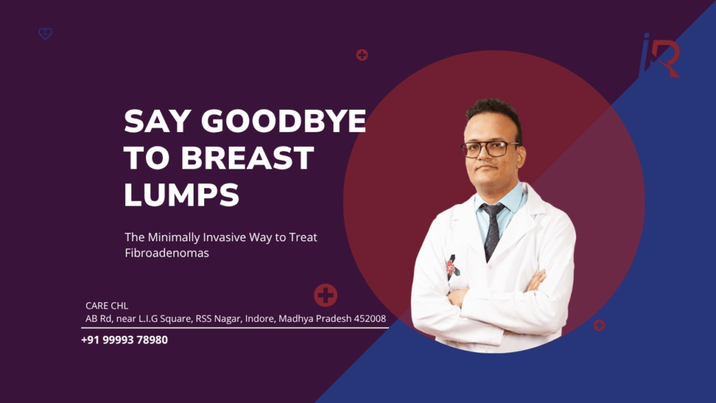 Say Goodbye to Breast Lumps: The Minimally Invasive Way to Treat Fibroadenomas