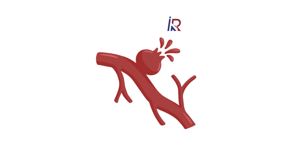 What Is a Brain Aneurysm? Signs You Should Never Ignore