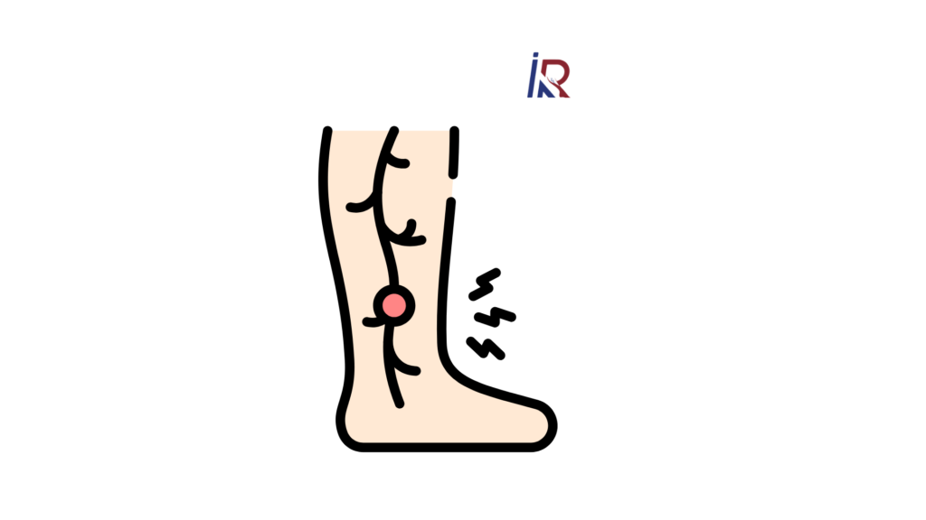Leg Pain or Something Serious? How to Spot DVT Before It Becomes Life-Threatening