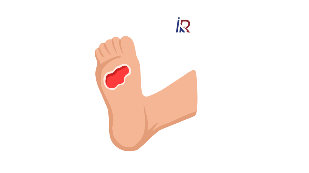 How to Save a Diabetic Foot From Amputation | Modern Minimally Invasive Solutions
