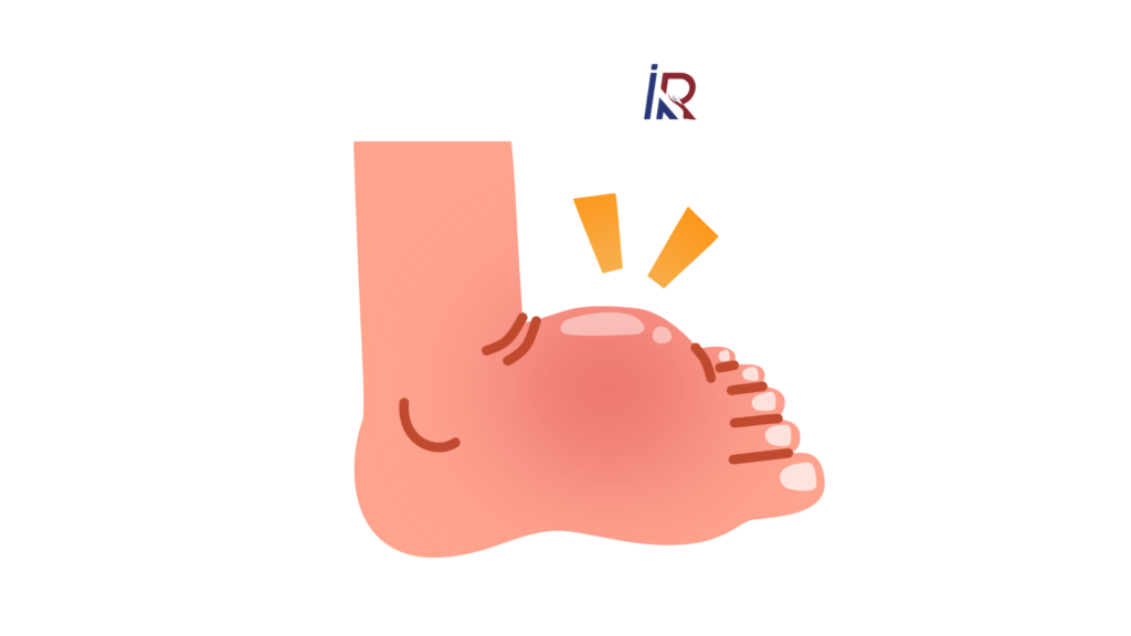 How to Save a Diabetic Foot From Amputation | Modern Minimally Invasive Solutions