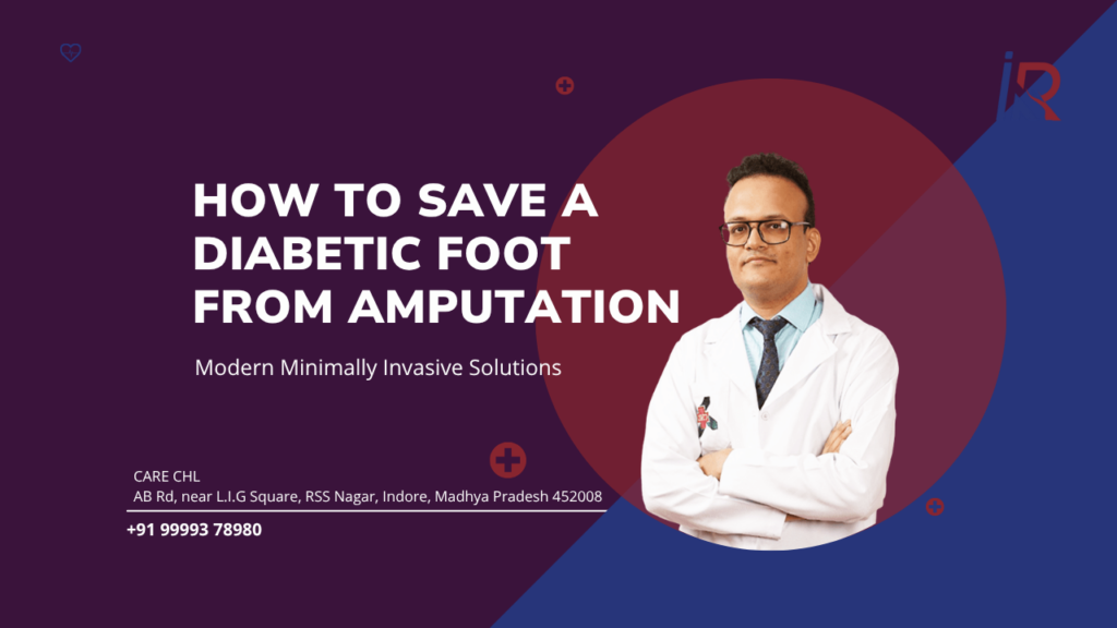 How to Save a Diabetic Foot From Amputation | Modern Minimally Invasive Solutions