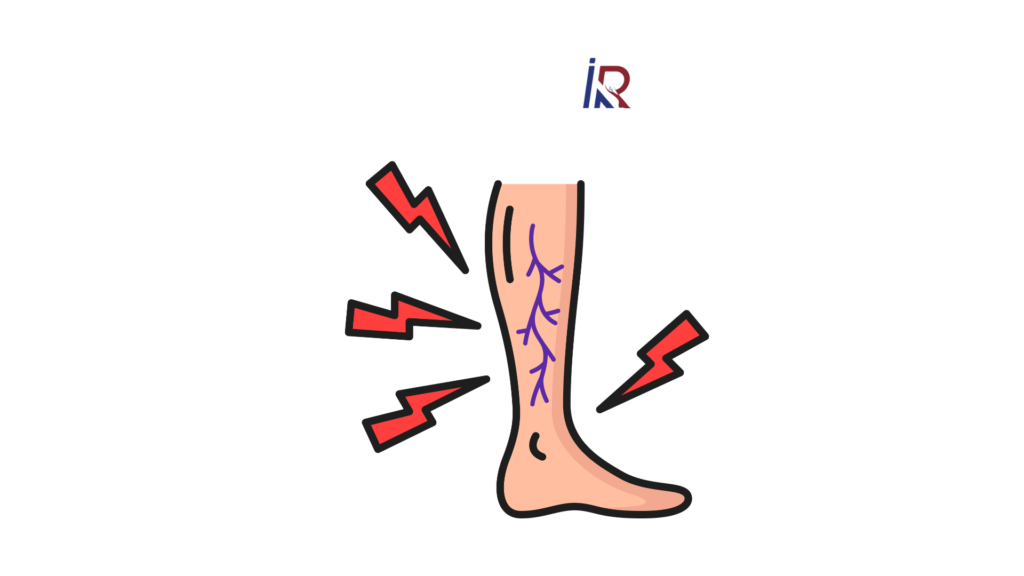 Leg Pain or Something Serious? How to Spot DVT Before It Becomes Life-Threatening