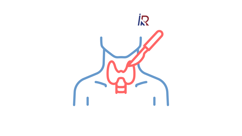 Thyroid Surgery vs. Radiofrequency Ablation: A Scar-Free Alternative Explained