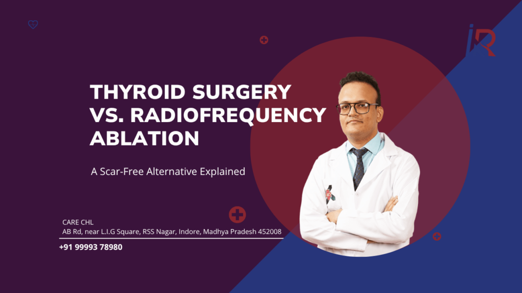 Thyroid Surgery vs. Radiofrequency Ablation: A Scar-Free Alternative Explained
