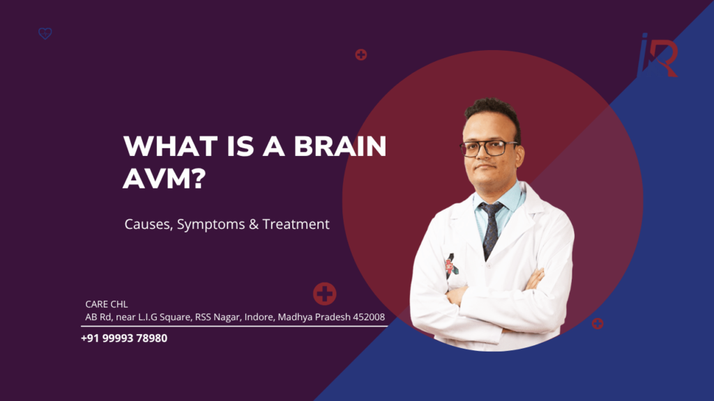 What Is a Brain AVM? Causes, Symptoms & Treatment