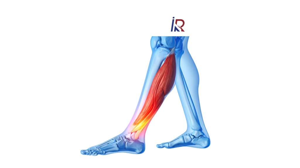 Leg Pain or Something Serious? How to Spot DVT Before It Becomes Life-Threatening