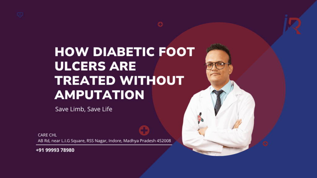Save Limb, Save Life: How Diabetic Foot Ulcers Are Treated Without Amputation