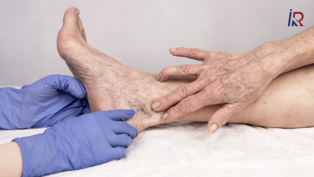 Laser vs. RFA vs. Sclerotherapy: Varicose Vein Guide