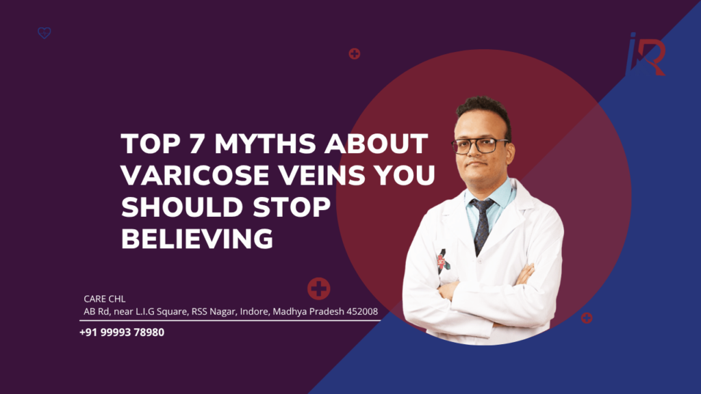 Top 7 Myths About Varicose Veins You Should Stop Believing