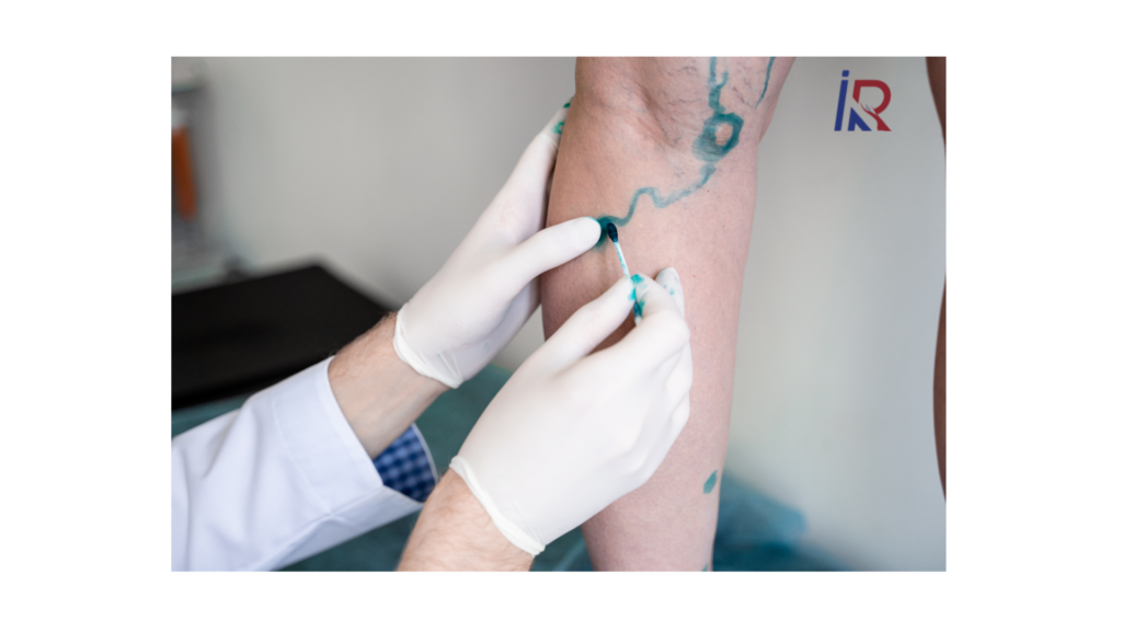 Vascular Surgeon in Indore | Dr. Alok Kumar Udiya, CARE CHL 3 Vascular Surgeon in Indore | Dr. Alok Kumar Udiya, CARE CHL