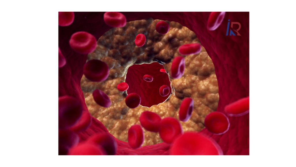 Vascular Surgeon in Indore | Dr. Alok Kumar Udiya, CARE CHL 1 Vascular Surgeon in Indore | Dr. Alok Kumar Udiya, CARE CHL