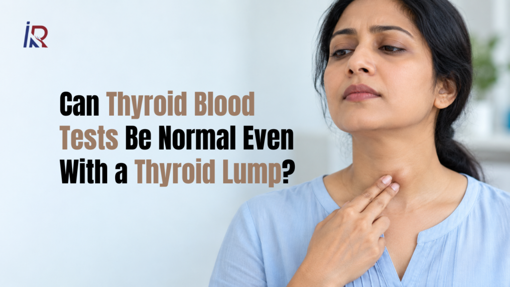 Can Thyroid Blood Tests Be Normal Even With a Thyroid Lump?