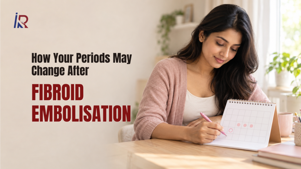 How Your Periods May Change After Fibroid Embolisation