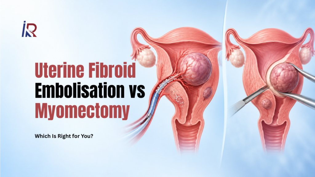 Uterine Fibroid Embolisation vs Myomectomy: Which Is Right for You?