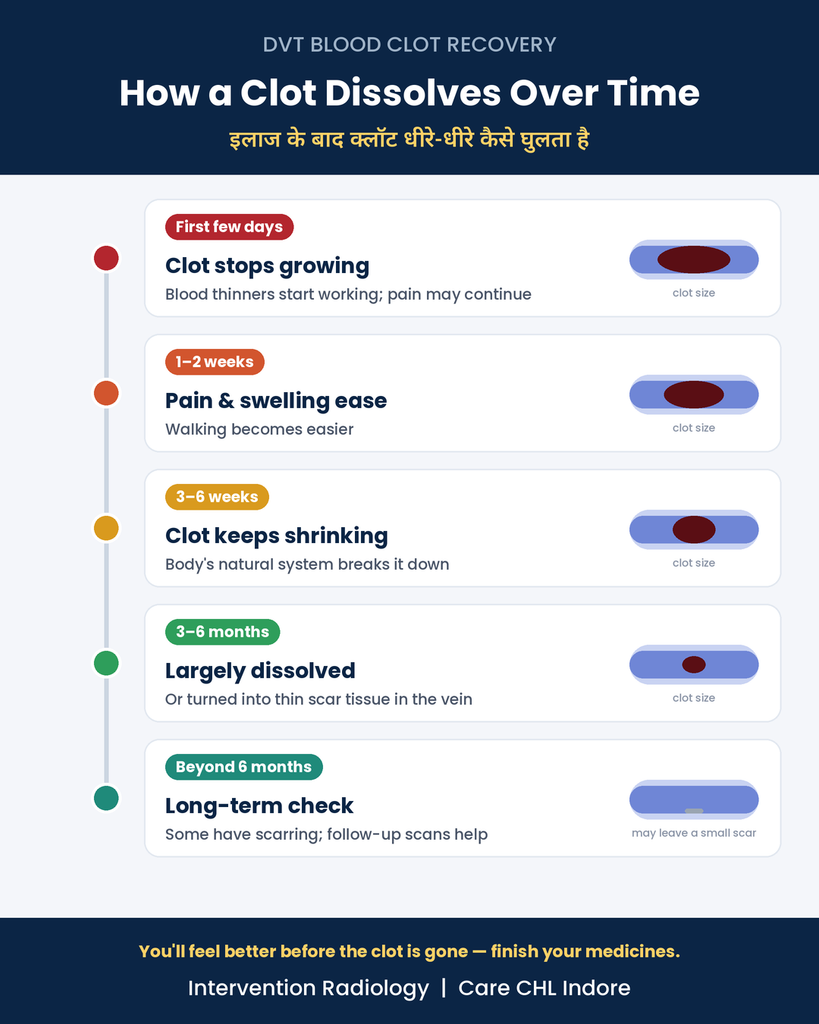 DVT blood clot dissolve timeline