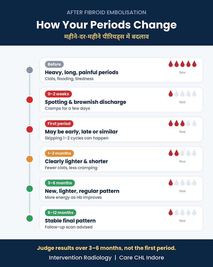 How Your Periods May Change After Fibroid Embolisation 2 Period changes timeline after fibroid embolisation