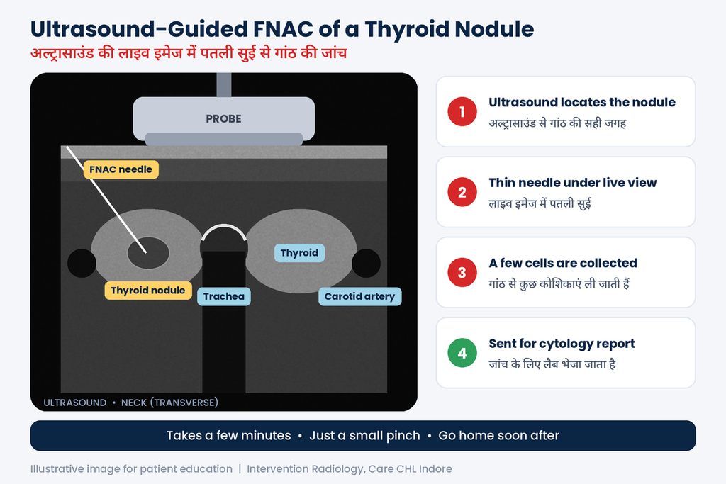 Ultrasound-guided FNAC for thyroid lump in Indore
